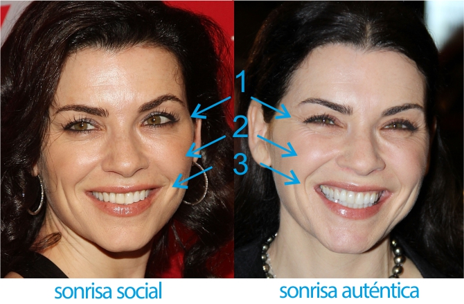 El Test De Las Sonrisas