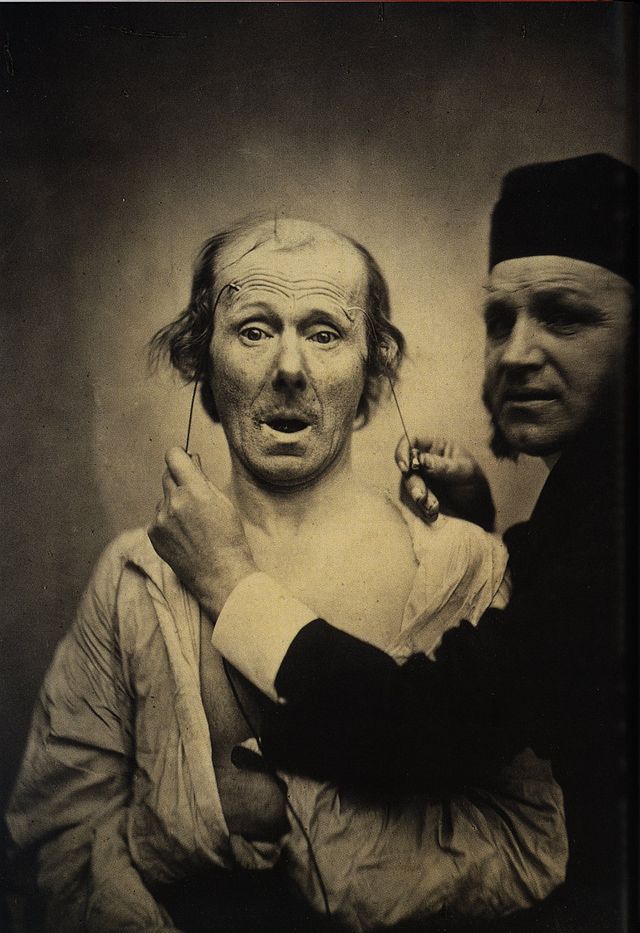 Guillaume Duchenne electroestimulacón facial